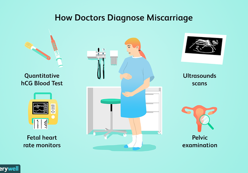 如何诊断流产