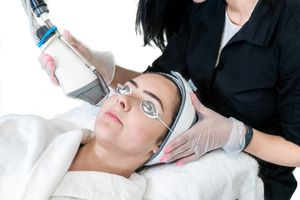 女性接受激光皮肤修复