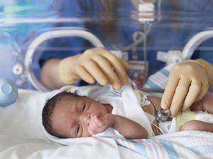 婴儿婴儿的婴儿卵巢液。