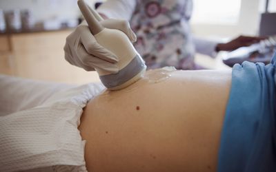 孕妇接受超声检查