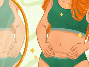 Illustration of woman in bra and underwear holding c section scar