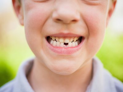 Smiling kid with mising tooth