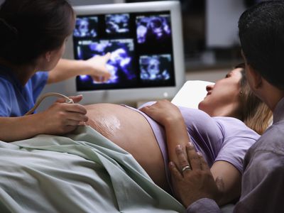 Female doctor pointing to ultrasound picture with pregnant woman