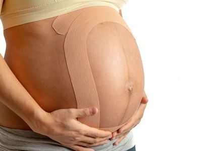 Pregnant woman with therapeutic tape