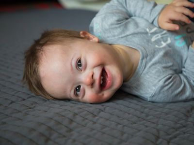 Cute baby boy with Down syndrome