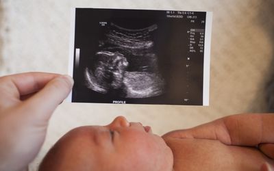 一个人拿着一个男婴的超声波图像