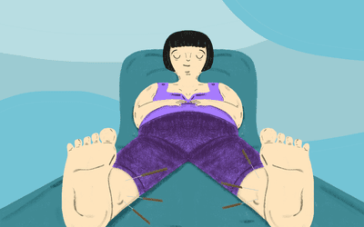 Illustration of pregnant woman getting acupuncture