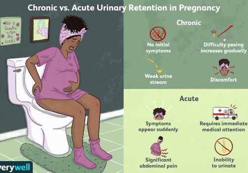 了解妊娠期慢性和急性尿潴留华体会体育官方人口