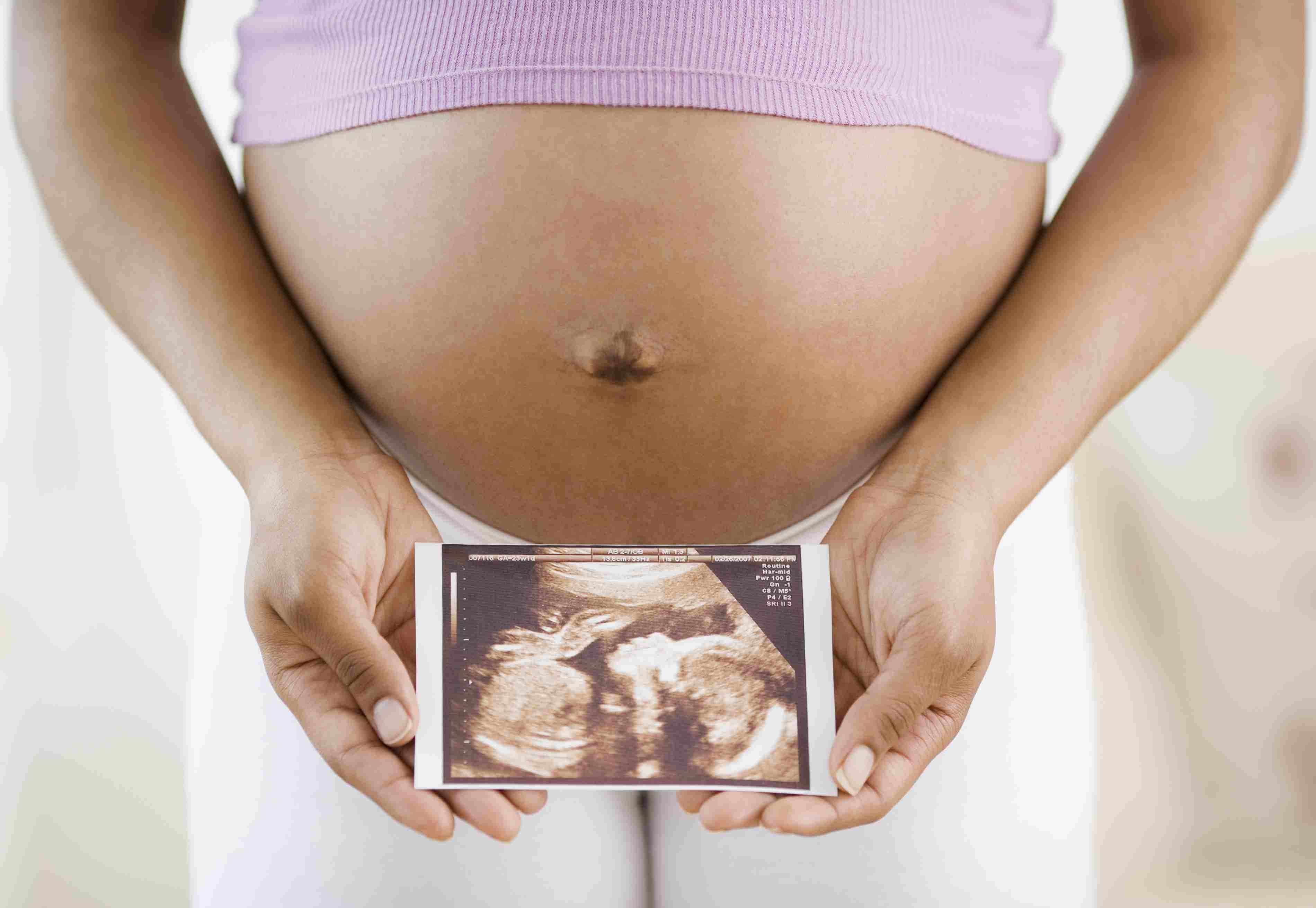孕妇拿着一张超声波照片