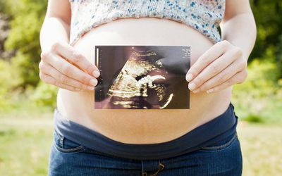 孕妇拿着她孩子的扫描图。