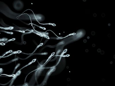 Computer illustraton of sperm swimming, unlike with necrozoospermia where sperm don't move