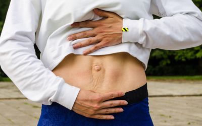 A women showing her stomach and the area with diastasis recti.