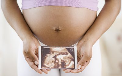 孕妇拿着一张超声波照片