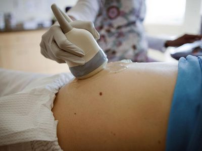 A pregnant woman getting an ultrasound of her abdomen